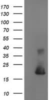 CST4 / Cystatin S Antibody (clone OTI2H10)
