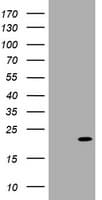 Monoclonal Mouse anti-Human CDKN2C / p18 INK4c Antibody (clone OTI2D7, WB)