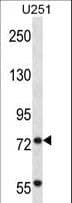 KIAA0517 / TRIM2 Antibody (aa592-621)