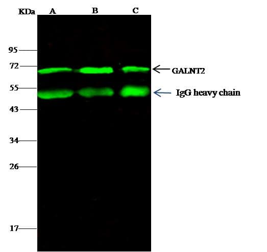 Polyclonal Rabbit anti-Human GALNT2 Antibody (Preservative Free, IHC, IF, WB)