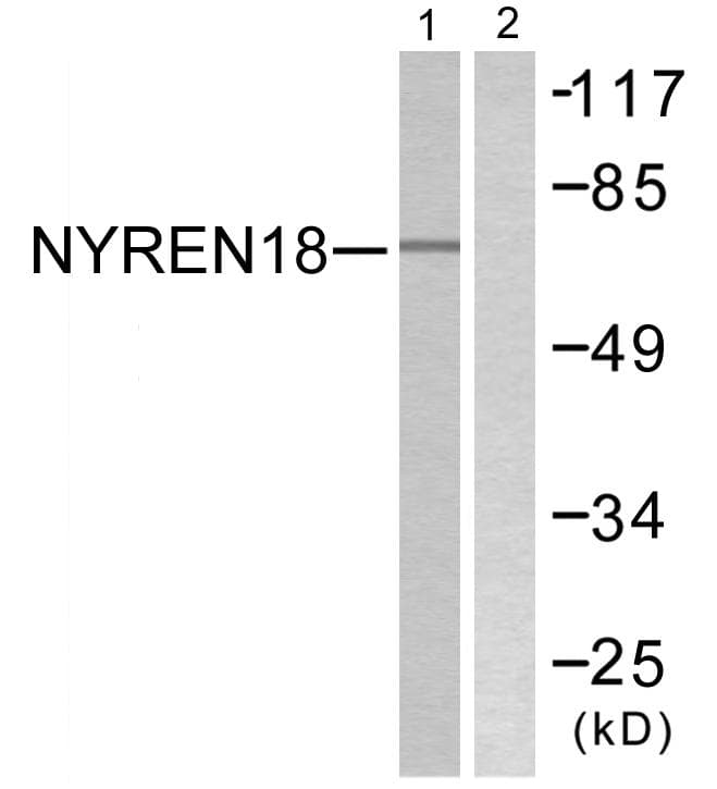 Polyclonal Rabbit anti-Human NUB1 Antibody (IHC, WB)