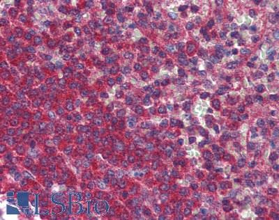 IHC-plus™ Polyclonal Rabbit anti-Human VIPERIN / RSAD2 Antibody (IHC, IF, WB)