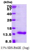 Human CRABP1 / CRABP Protein (Recombinant)