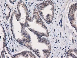 EIF4E2 / IF4e Antibody (clone OTI1F11)