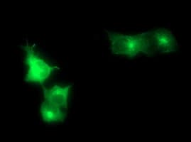 PathPlus™ SYP / Synaptophysin Antibody (clone 1C9)