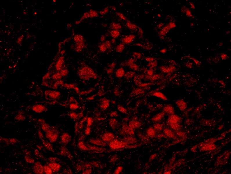 BRCA1 Antibody (aa700-750)