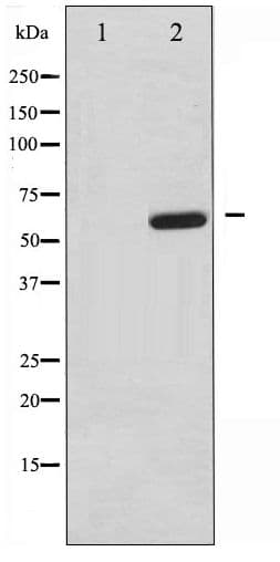 Polyclonal Rabbit anti-Human MAP3K7 / TAK1 Antibody (phospho-Thr187, WB)