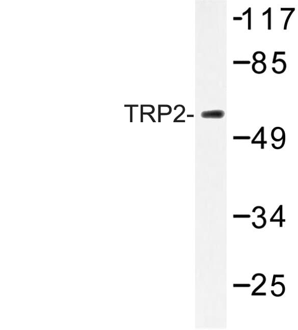 DCT / Dopachrome Tautomerase Antibody (Lys89)