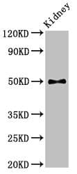 Polyclonal Rabbit anti-Human PDK1 Antibody (IHC, WB)