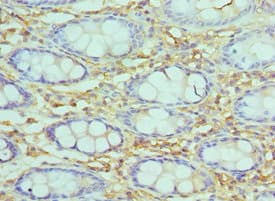 Polyclonal Rabbit anti-Human SMARCC2 Antibody (aa300-650, IHC, WB)