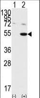 IHC-plus™ GSK3A / GSK3 Alpha Antibody (aa448-478)