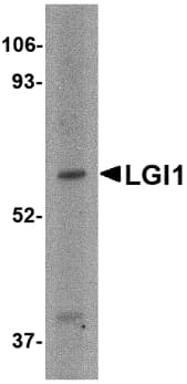 Polyclonal Rabbit anti-Human LGI1 Antibody (IHC, IF, WB)