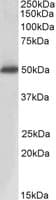 PathPlus™ ACPP / PAP Antibody (aa200-300)