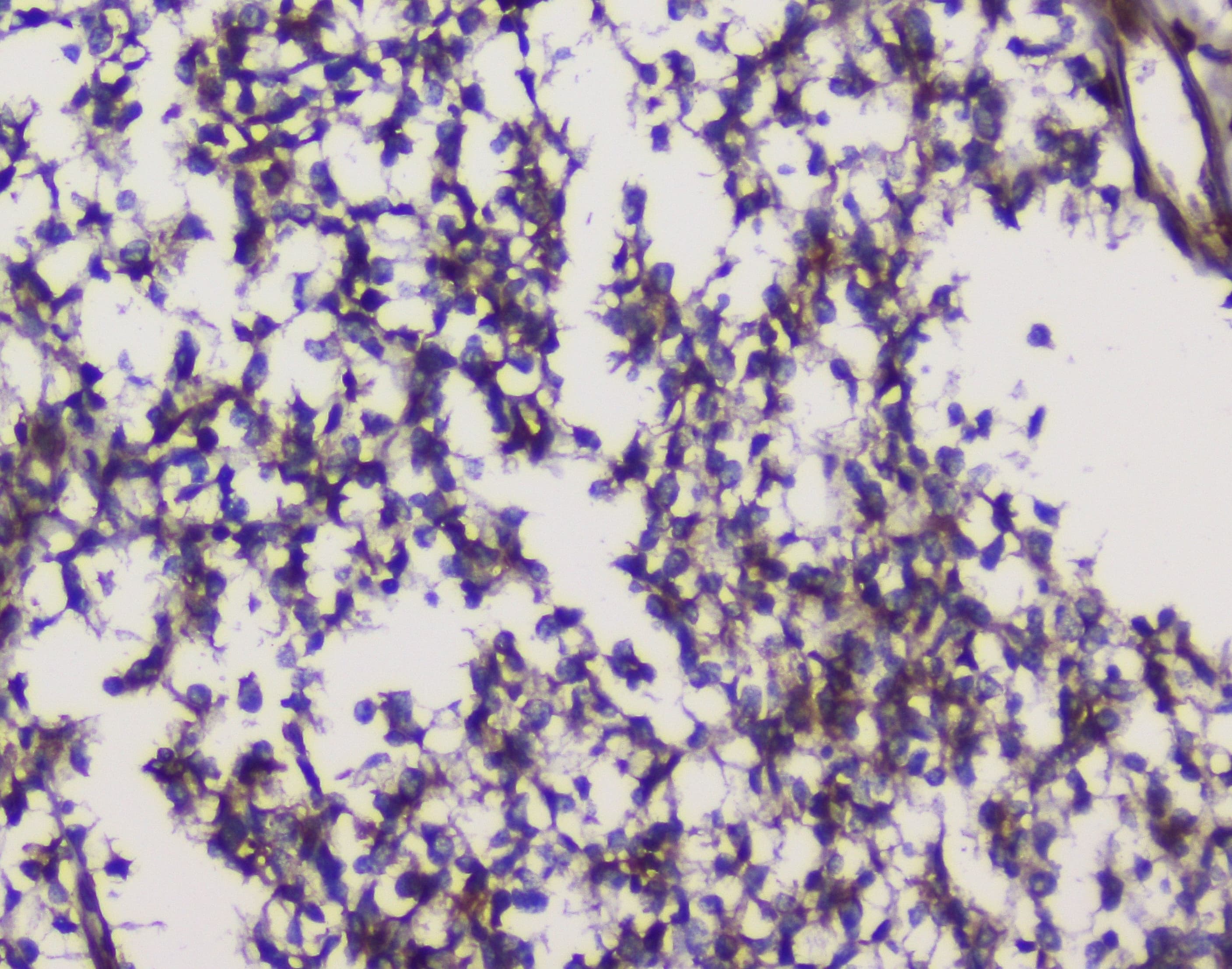 Polyclonal Rabbit anti-Human GRIK1 / GLUR5 Antibody (aa271-450, WB)