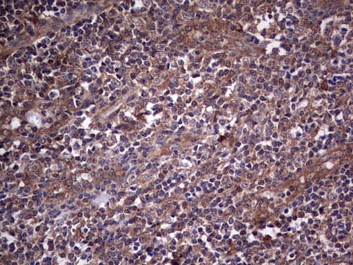 Monoclonal Mouse anti-Human SNX12 Antibody (clone OTI8A11, IHC, WB)