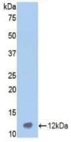 VTN / Vitronectin Antibody (aa400-468)