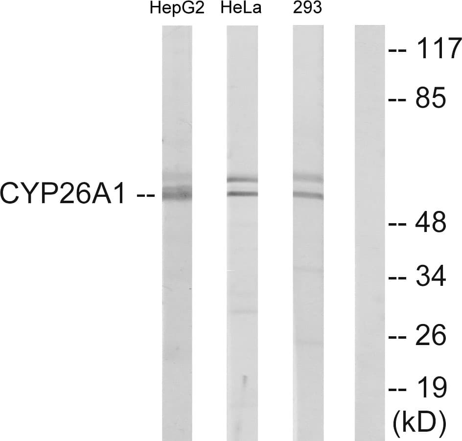 CYP26 / CYP26A1 Antibody (aa251-300)