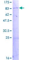 Human AOAH / Acyloxyacyl Hydrolase Protein (Recombinant GST)