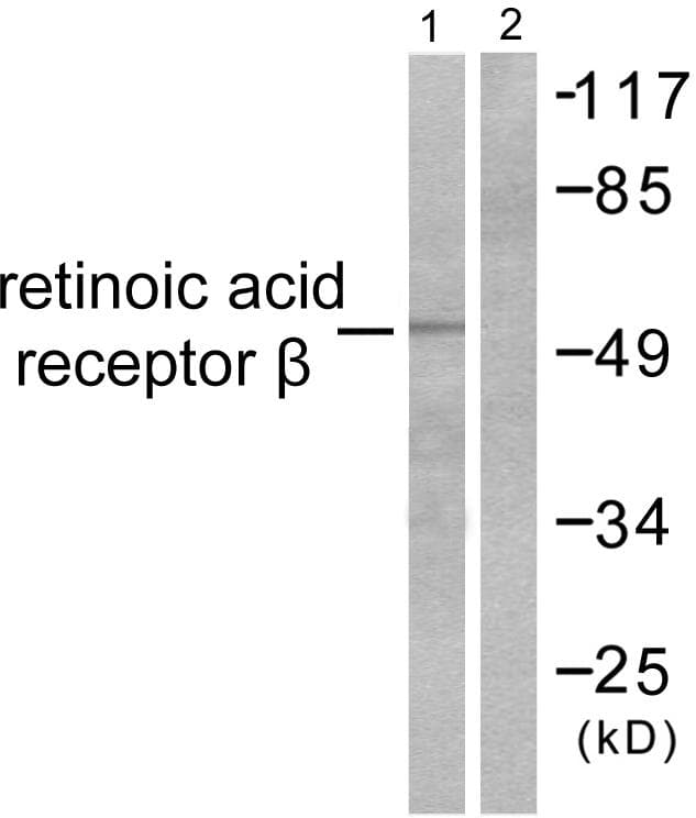 RARB / RAR Beta Antibody
