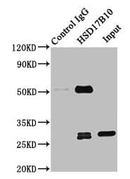 HSD17B10 / HADH2 Antibody (aa2-261)