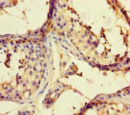 Polyclonal Rabbit anti-Human ARHGAP42 Antibody (IHC, WB)