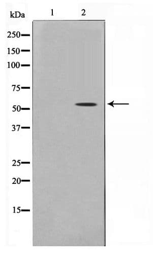 TP53 / p53 Antibody