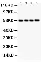 PKM / Pyruvate Kinase, Muscle Antibody (aa475-500)
