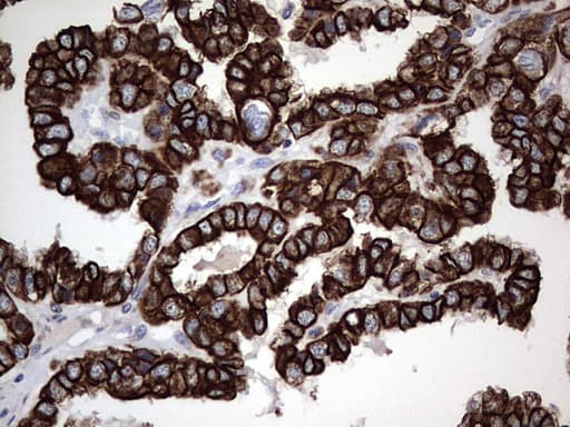 Monoclonal Rat anti-Human Acidic Cytokeratin Antibody (clone 9H3, IHC)