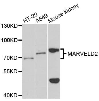 Polyclonal Rabbit anti-Human MARVELD2 / Tricellulin Antibody (WB)