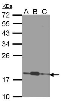 IHC-plus™ COMMD7 Antibody (Internal)