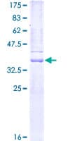 Human MMP7 / Matrilysin Protein (Recombinant GST, N-terminus)