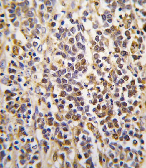 IHC-plus™ Polyclonal Rabbit anti-Human ALDH1A3 Antibody (aa318-348, IHC, WB)