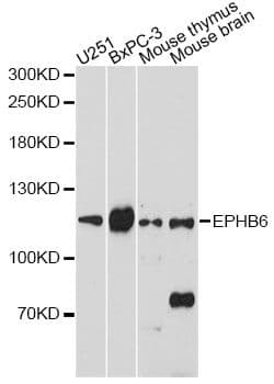 Polyclonal Rabbit anti-Human EPHB6 / EPH Receptor B6 Antibody (WB)