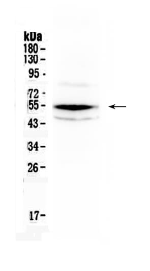 Polyclonal Rabbit anti-Human CHEK1 / CHK1 Antibody (WB)