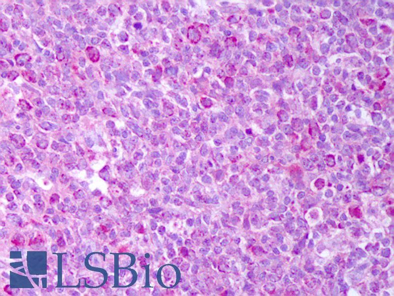 IHC-plus™ Polyclonal Rabbit anti-Human TNFSF11 / RANKL / TRANCE Antibody (IHC, WB)