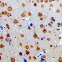 LBC / AKAP13 Antibody (Internal)