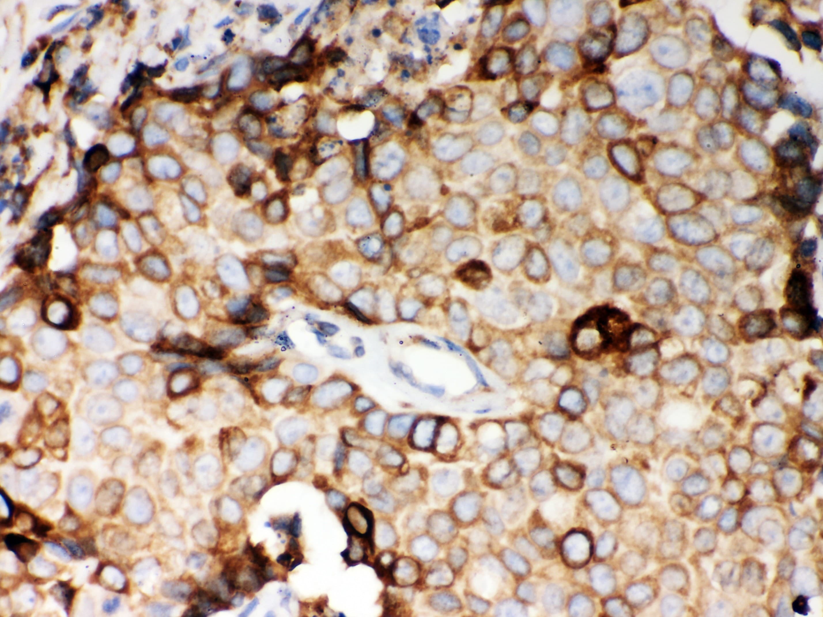GOK / STIM1 Antibody (aa45-74)