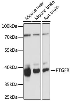 FP / PTGFR Antibody