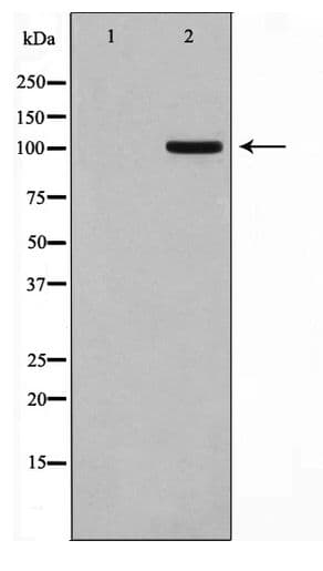 GPRIN1 / GRIN1 Antibody