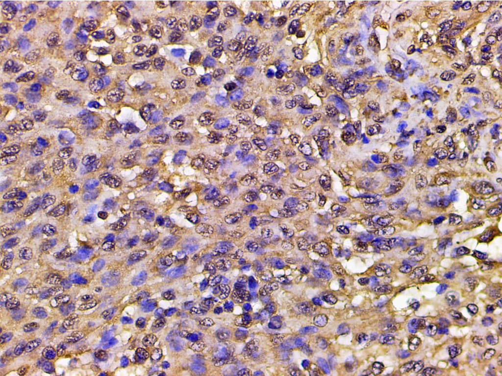PIK3R1 / p85 Alpha Antibody (phospho-Tyr607)