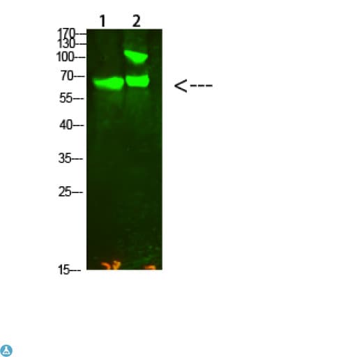 Polyclonal Rabbit anti-Human COL13A1 / Collagen XIII Antibody (WB)