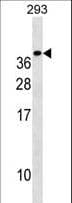 IHC-plus™ Polyclonal Rabbit anti-Human TREM1 Antibody (aa162-191, IHC, WB)