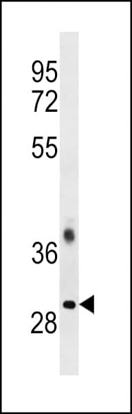 TRA2B / SFRS10 Antibody (aa208-237)