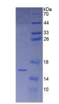 Human DEFA1 / Defensin Alpha 1 Protein (Recombinant His)