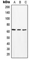 PathPlus™ Polyclonal Rabbit anti-Human SLC16A2 / MCT8 Antibody (Internal, IHC, WB)