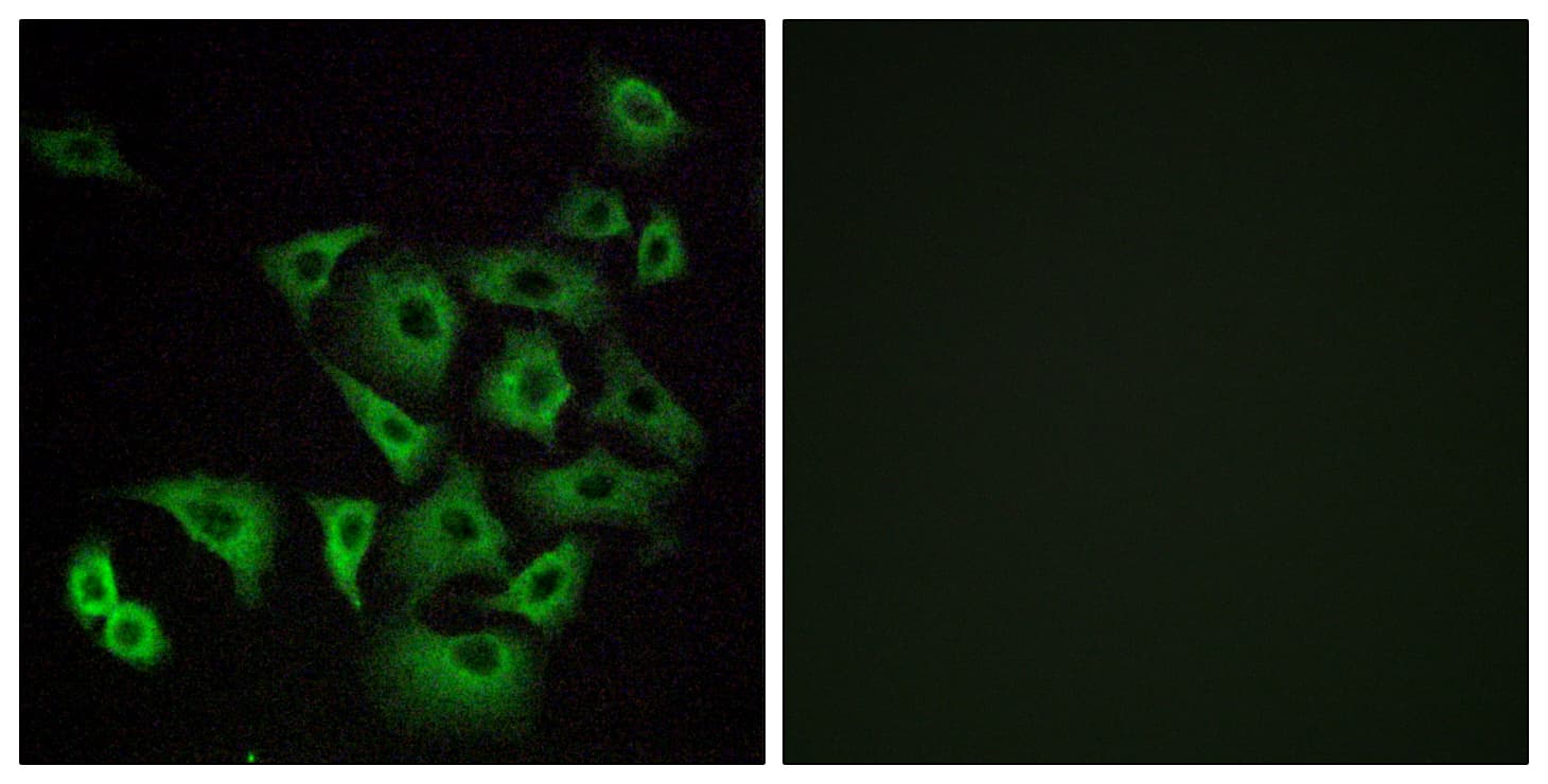 Polyclonal Rabbit anti-Human OR4K14 Antibody (aa261-310, IF, WB)
