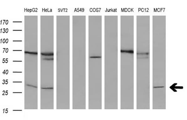 BCL2 / Bcl-2 Antibody (clone OTI4C1)