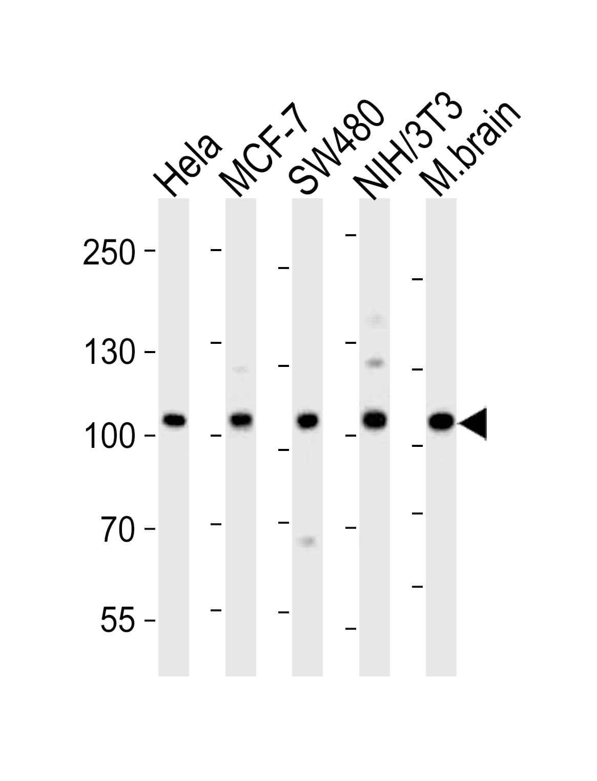 Polyclonal Rabbit anti-Human EPHA4 / EPH Receptor A4 Antibody (aa383-417, WB)
