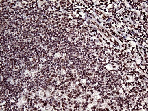 L3MBTL3 Antibody (aa98-319, clone OTI6D7)