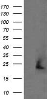 APCS / Serum Amyloid P / SAP Antibody (clone OTI1D6, Carrier-free)